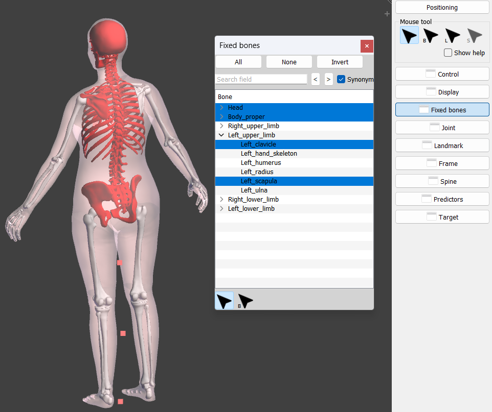 Fixing bones